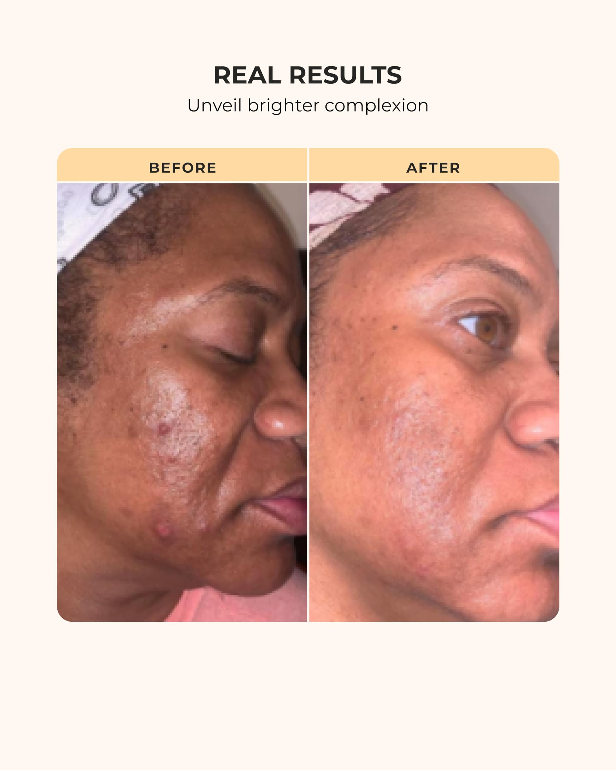 Buttah Transforming Kit for Melanin Rich Skin | Moisturizer 2 oz | Vitamin C Serum 1 oz | Cleanser 3.4 oz | Black Owned Skincare