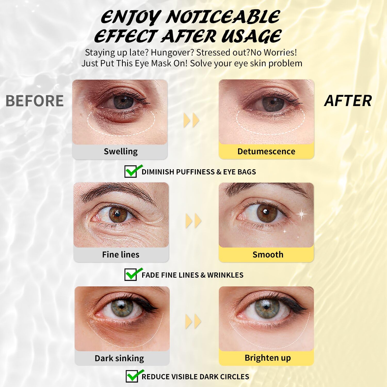 Maskiss Under Eye Patches, eye mask, Collagen Skin Care Products, Eye Patches for Puffy Eyes, eye masks for dark circles and puffiness