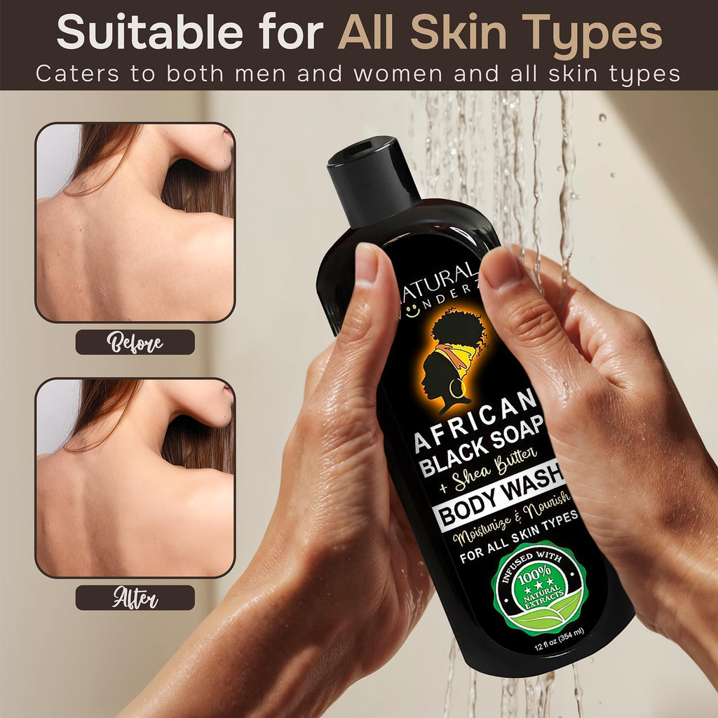 African Black Soap and Shea Butter Body Wash, Shower Gel, Promotes Acne Treatment, Contains All Natural Extracts, Vegan, and Sulfate-Free Body Scrub